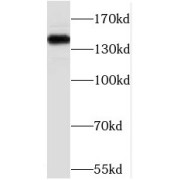 WB analysis of HeLa cells, using PHF14 antibody (1/1000 dilution).