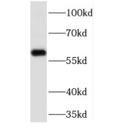 WB analysis of HeLa cells, using PHF17 antibody (1/500 dilution).