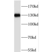 WB analysis of HeLa cells, using PHF20 antibody (1/1000 dilution).