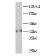 WB analysis of HeLa cells, using PHF6 antibody (1/1000 dilution).