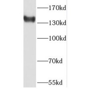 WB analysis of SMMC-7721 cells, using PHKA2 antibody (1/600 dilution).