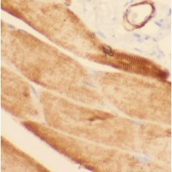 Phosphorylase Kinase Regulatory Subunit Beta (PHKB) Antibody