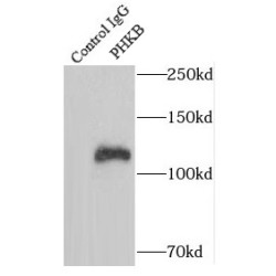 Phosphorylase Kinase Regulatory Subunit Beta (PHKB) Antibody