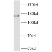 WB analysis of mouse heart tissue, using PHKB antibody (1/1000 dilution).