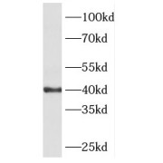 WB analysis of mouse skeletal muscle tissue, using PHKG1 antibody (1/500 dilution).