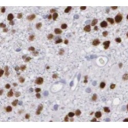 Paired Like Homeobox 2b (PHOX2B) Antibody