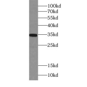 WB analysis of Neuro-2a cells, using PHOX2B antibody (1/2500 dilution).