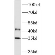 WB analysis of mouse brain tissue, using PHYHIP antibody (1/1000 dilution).