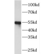 WB analysis of A2780 cells, using PI16 antibody (1/200 dilution).