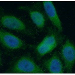 PI3K p85 (alpha) Antibody