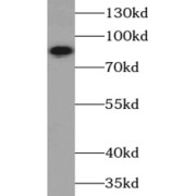 WB analysis of Neuro-2a cells, using PIK3R1 antibody (1/4000 dilution).