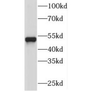 WB analysis of HepG2 cells, using PI4K2A antibody (1/800 dilution).