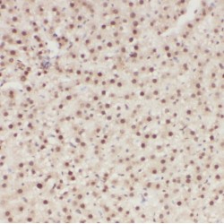 Phosphatidylinositol 4-Kinase Type 2 Beta (PI4K2B) Antibody