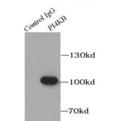 Phosphatidylinositol 4-Kinase Beta (PI4KB) Antibody