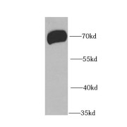 WB analysis of mouse brain tissue, using PIAS3 antibody (1/1000 dilution).