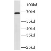 WB analysis of mouse thymus tissue, using PIF1 antibody (1/800 dilution).