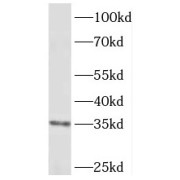 WB analysis of HeLa cells, using PIG3 antibody (1/1000 dilution).