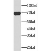 WB analysis of HeLa cells, using PIGS antibody (1/300 dilution).