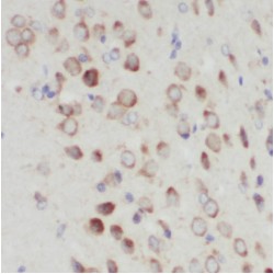 GPI Transamidase Component PIG-T (PIGT) Antibody