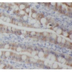 Phosphatidylinositol Glycan Anchor Biosynthesis Class Z (PIGZ) Antibody