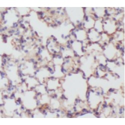 PIH1 Domain-Containing Protein 1 (PIH1D1) Antibody