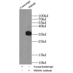 PIH1 Domain-Containing Protein 1 (PIH1D1) Antibody