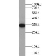 WB analysis of HeLa cells, using PIH1D1 antibody (1/1000 dilution).