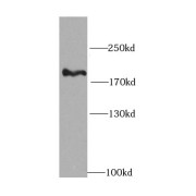 WB analysis of PC-3 cells, using PIK3C2A antibody (1/1500 dilution).