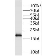 WB analysis of A549 cells, using PIK3C2G antibody (1/600 dilution).