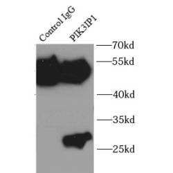 Phosphoinositide-3-Kinase Interacting Protein 1 (PIK3IP1) Antibody