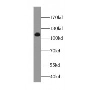 WB analysis of human retina tissue, using Pikachurin antibody (1/1000 dilution).
