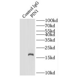 Peptidyl-Prolyl Cis-Trans Isomerase NIMA-Interacting 1 (PIN1) Antibody