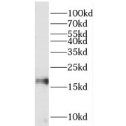 WB analysis of HEK-293 cells, using PIN1 antibody (1/1000 dilution).