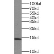 WB analysis of mouse liver tissue, using PIN4 antibody (1/500 dilution).