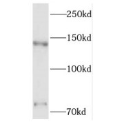 WB analysis of HeLa cells, using PNN antibody (1/600 dilution).