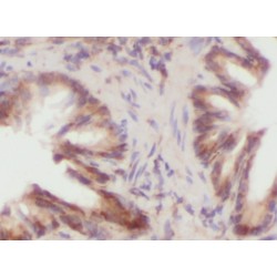 Phosphatidylinositol-4-Phosphate 5-Kinase Type 1 Beta (PIP5K1B) Antibody