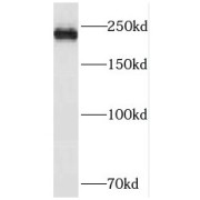 WB analysis of mouse lung tissue, using PIP5K3 antibody (1/300 dilution).