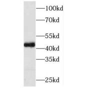 WB analysis of HEK-293 cells, using PIP5KL1 antibody (1/500 dilution).