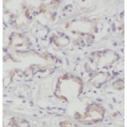 Phosphatidylinositol Transfer Protein Beta (PITPNB) Antibody