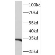 WB analysis of mouse lung tissue, using PITPNB antibody (1/500 dilution).