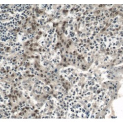 Pituitary Homeobox 1 (PITX1) Antibody