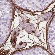 IHC-P analysis of human testis tissue, using PIWIL2 antibody (1/50 dilution).