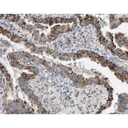 PKC alpha Antibody