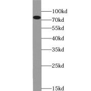 WB analysis of Jurkat cells, using PRKCA antibody (1/1000 dilution).