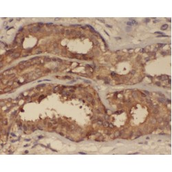 PKC beta Antibody