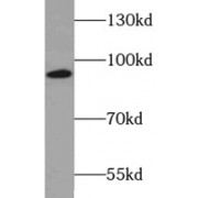 WB analysis of mouse lung tissue, using PKC epsilon antibody (1/1000 dilution).