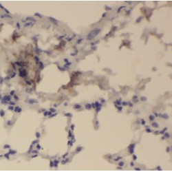 Pyruvate Kinase, Liver And RBC (PKLR) Antibody