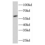 WB analysis of MCF7 cells, using PKLR antibody (1/1000 dilution).