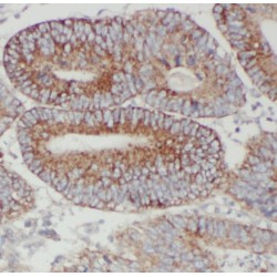 Pyruvate Kinase M1/2 (PKM) Antibody