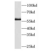 WB analysis of HepG2 cells, using PKM antibody (1/1000 dilution).